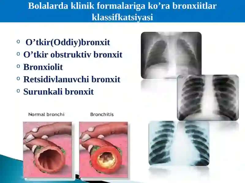 Viruslar va bakteriyalar 3