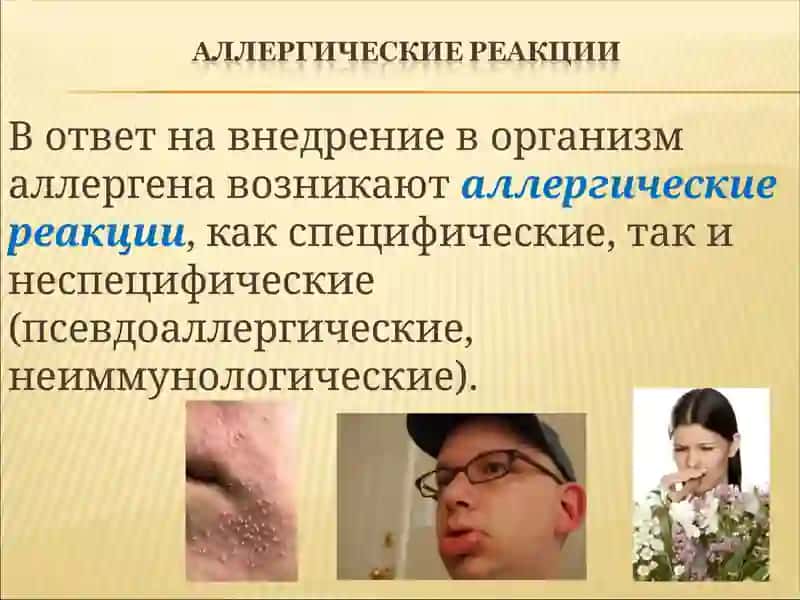 allergiya 3