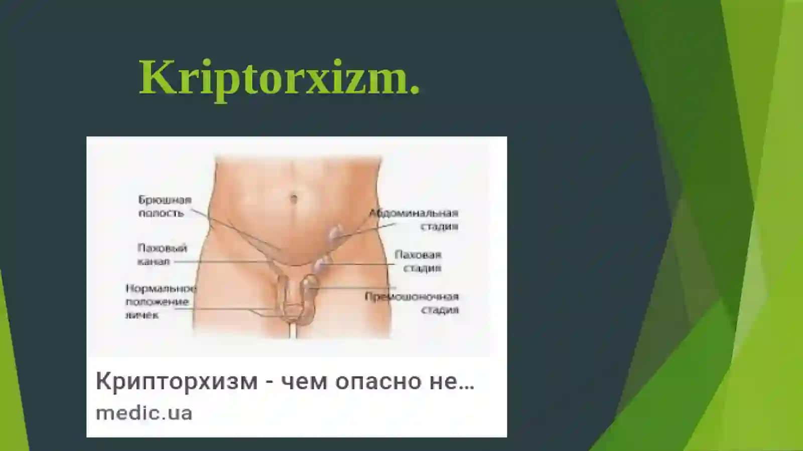 Kriptorxizm 3