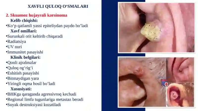 QULOQNING XAVFLI O‘SMALARI 3