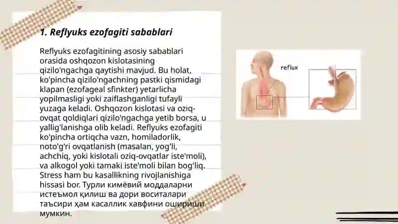 Reflyuks ezofagit 3