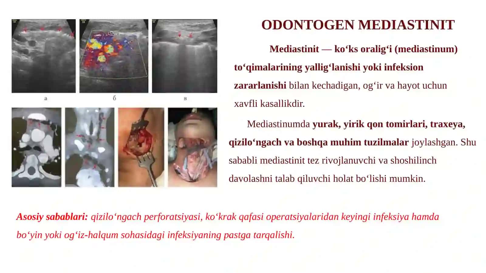 ODONTOGEN MEDIASTINIT 3