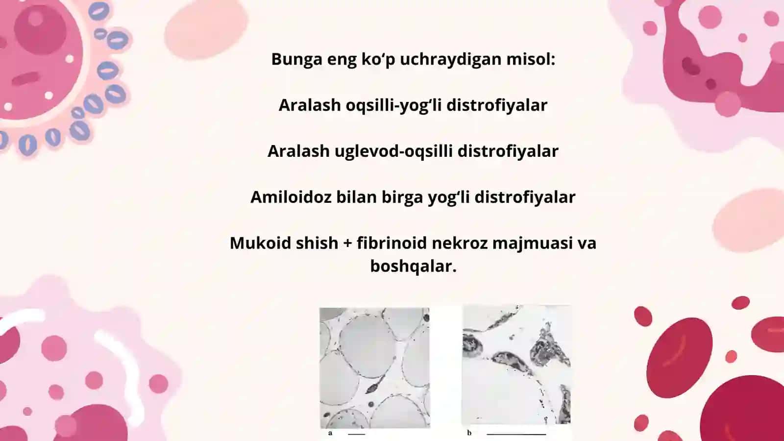 ARALASH DISTROFIYA 3