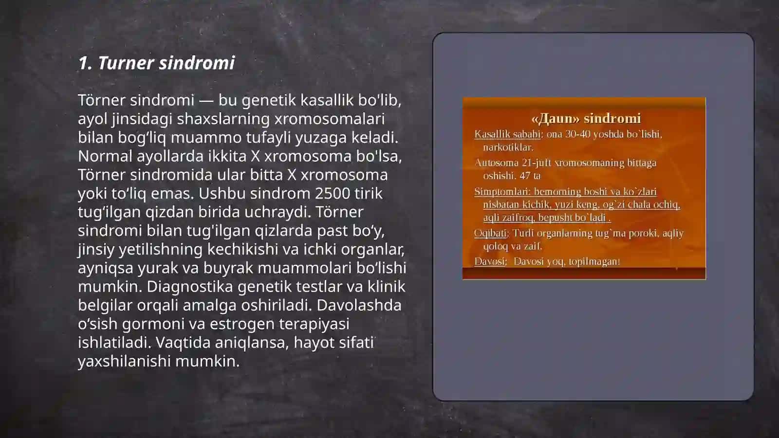 Turner sindromi 3