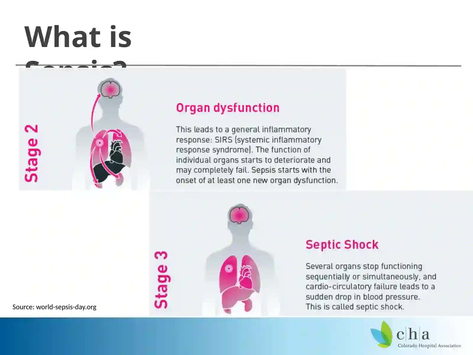 Sepsis 101 3