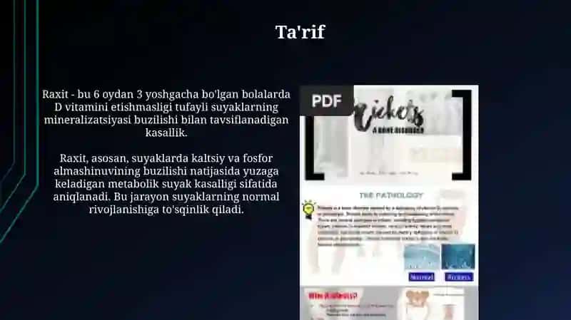 Raxit 3