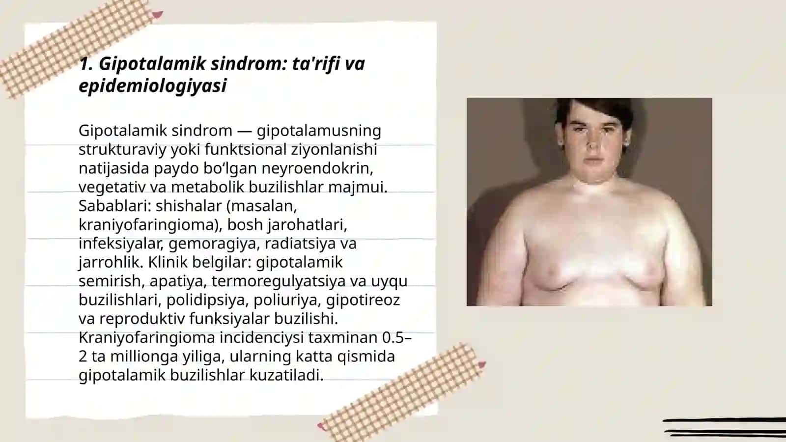 Gipotalamik sindrom 3