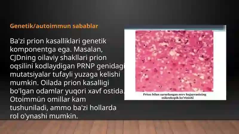Prion kasalligi 3