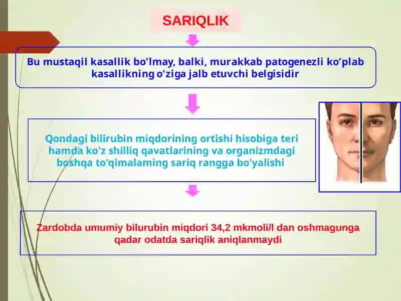Sariqlik bilan kechuvchi kasalliklar 3