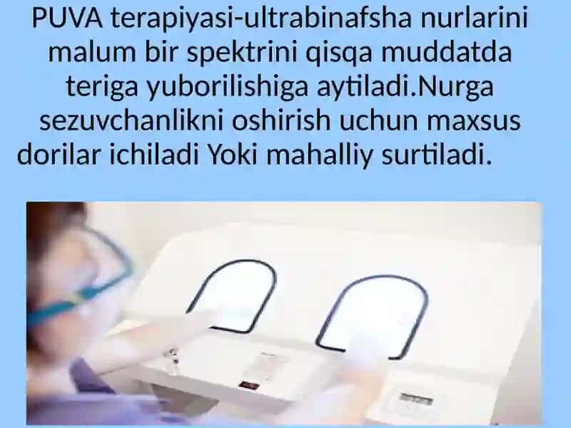 PUVA terapiyasi 3