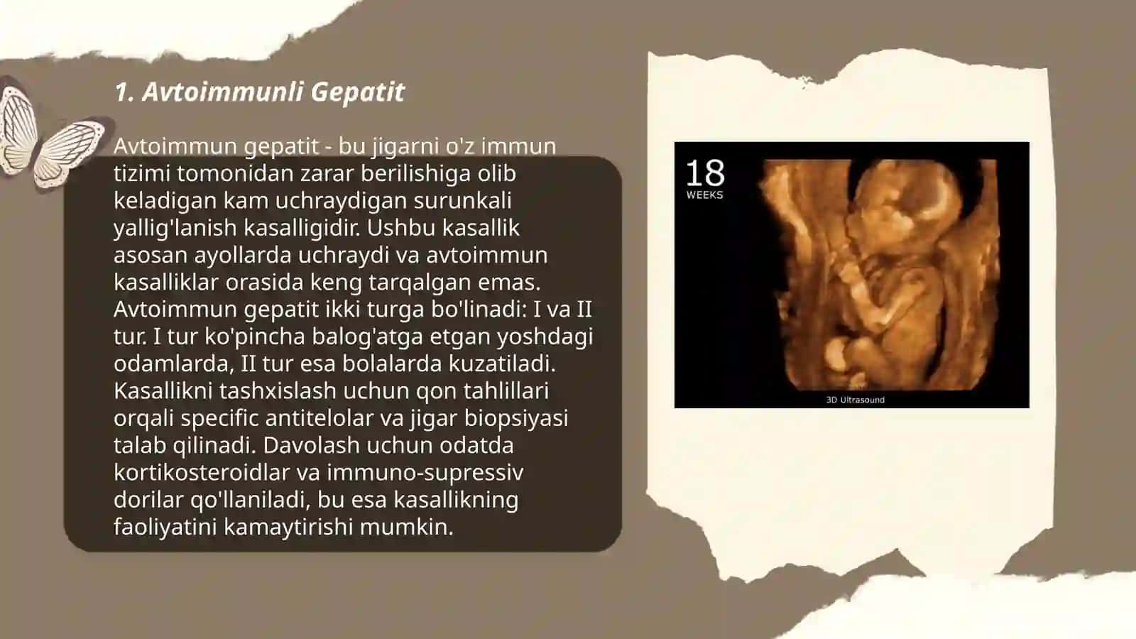 Avtoimmun Gepatit 3