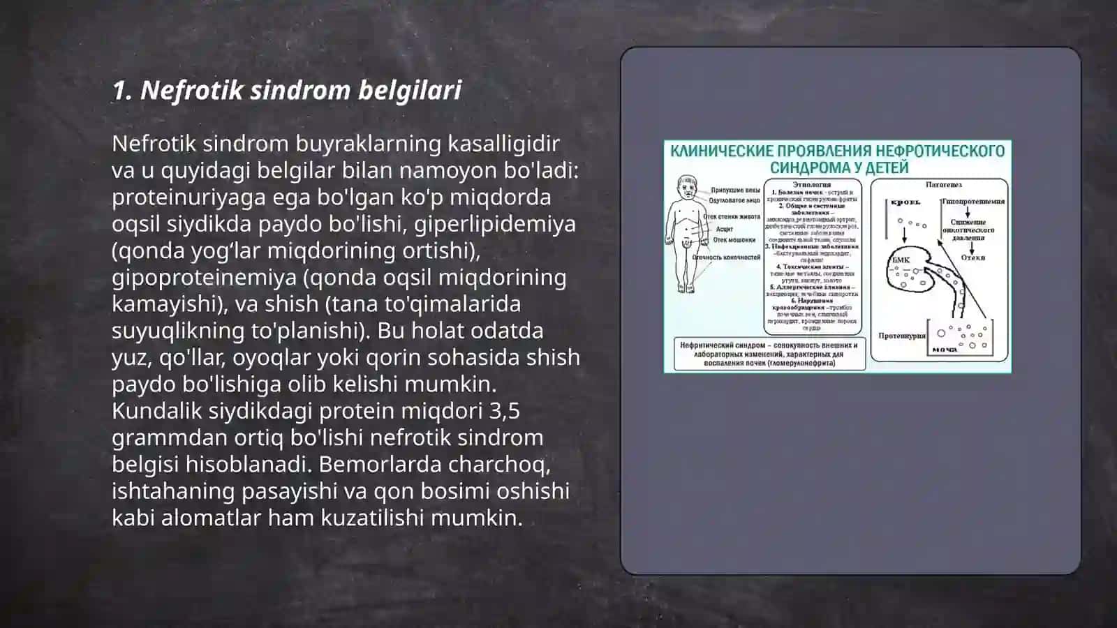Nefrotik sindrom belgilari 3