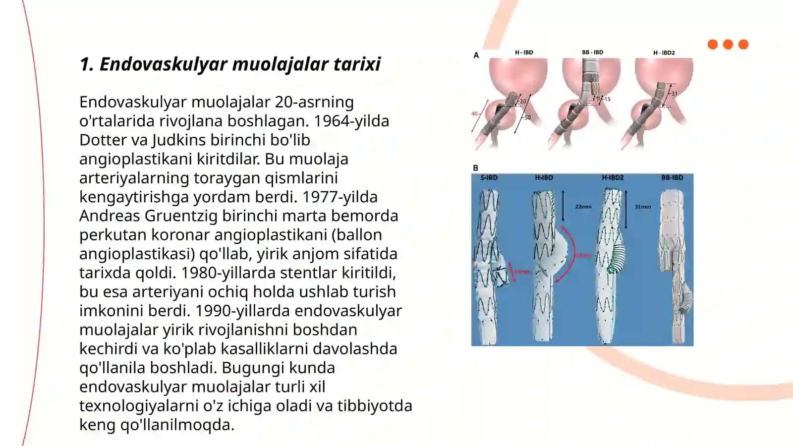 Endovaskulyar operatsiyalar 3