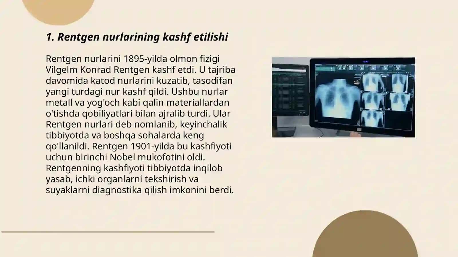 Rentgen nurlarini oʻrganish tarixi suyak va boʻgʻimlar rivojlanishini rentgen nurlari yordamida oʻrganish 3
