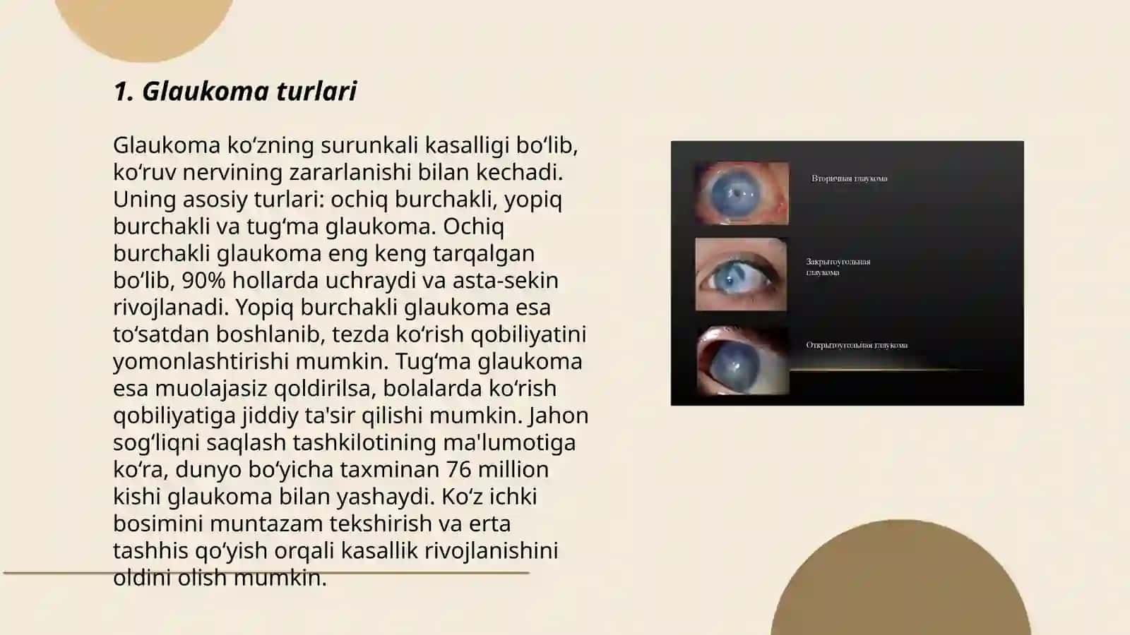 Glaukoma 3