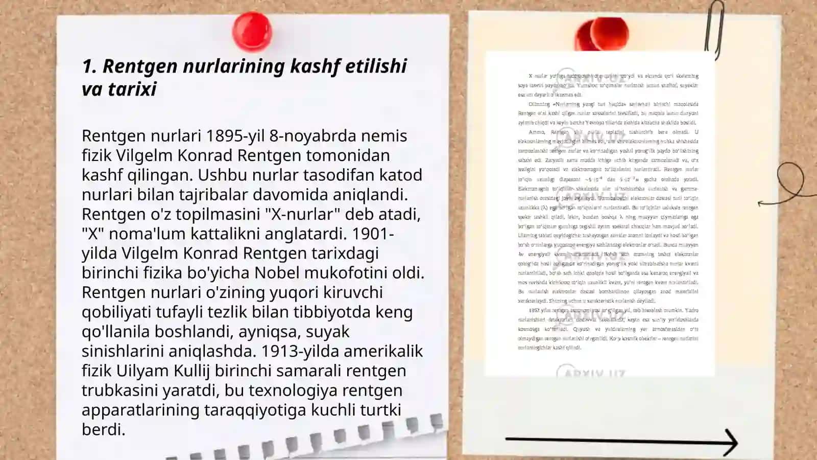 Rentgen nurlarini o'rganish tarixi, suyak va bo'g'imlar rivojlanishini rentgen nurlari yordamida o'rganish 3