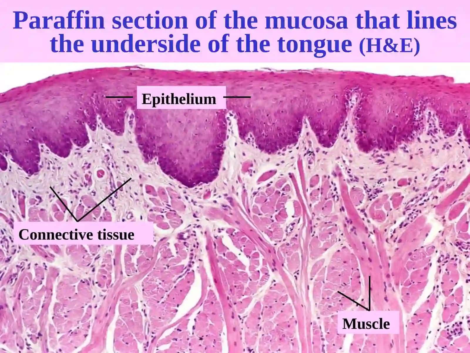EPITHELIUM 3