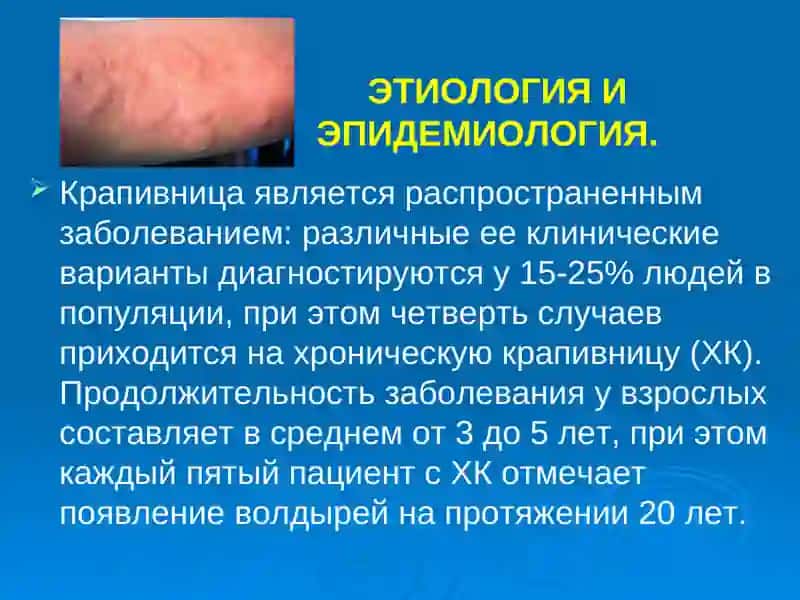 Крапивница 3