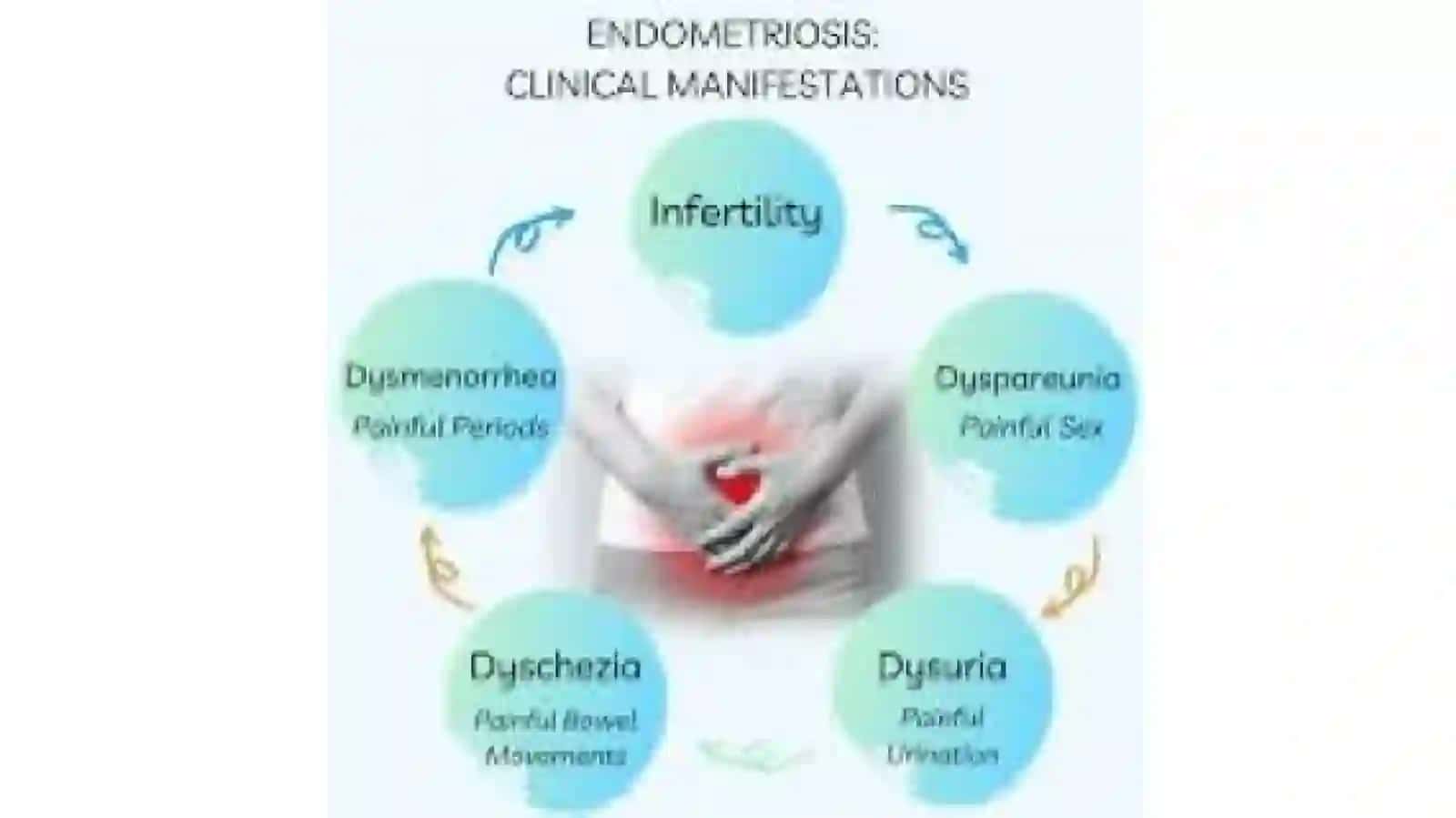 Endometriosis kilinikasi 3