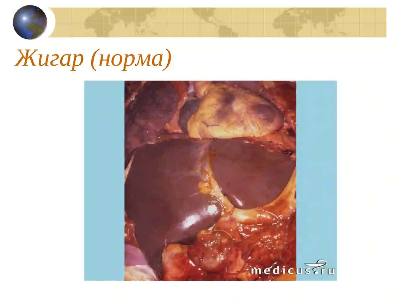 Сурункали гепатит 3