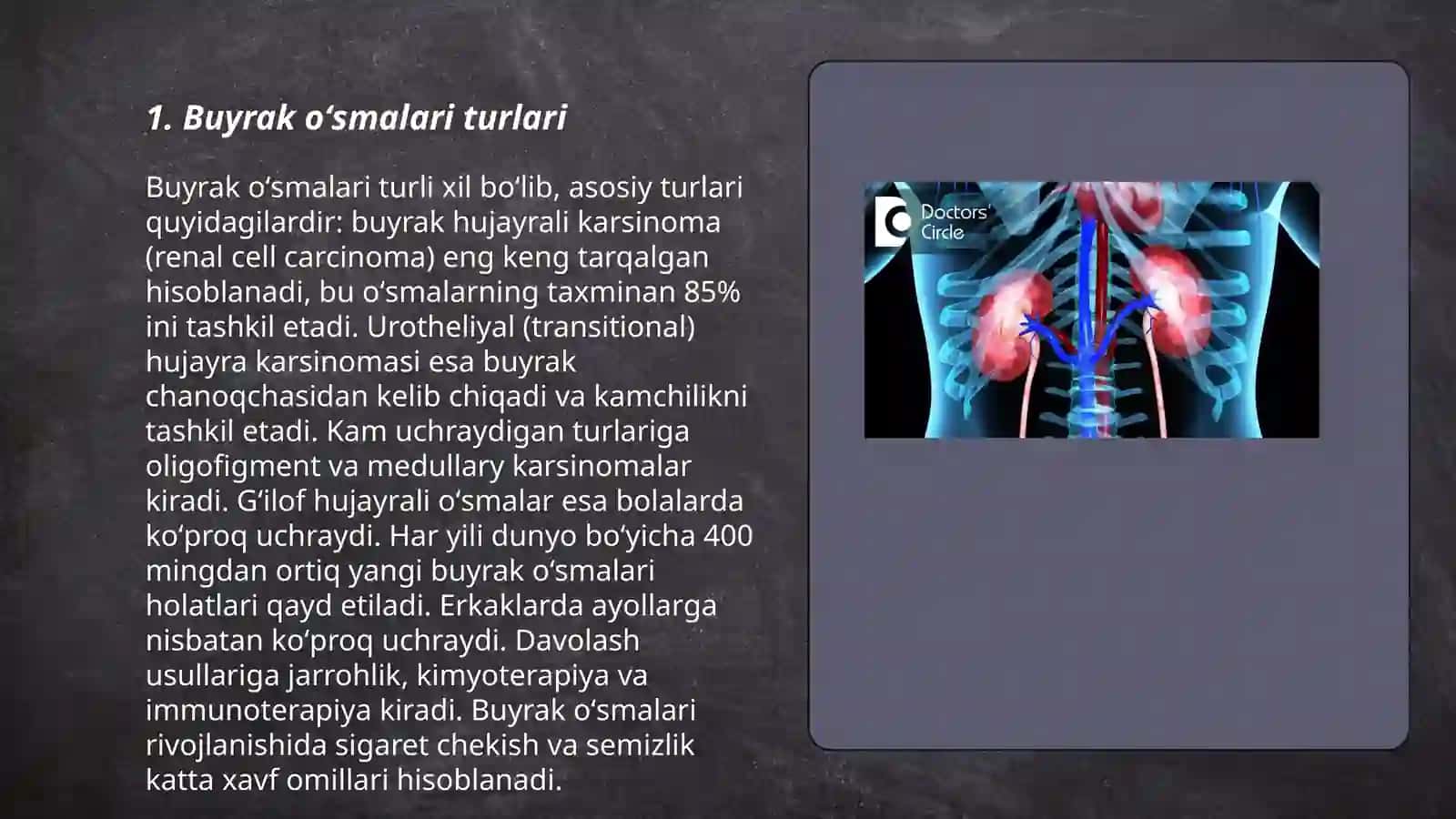 Buyrak oʻsmalari 3