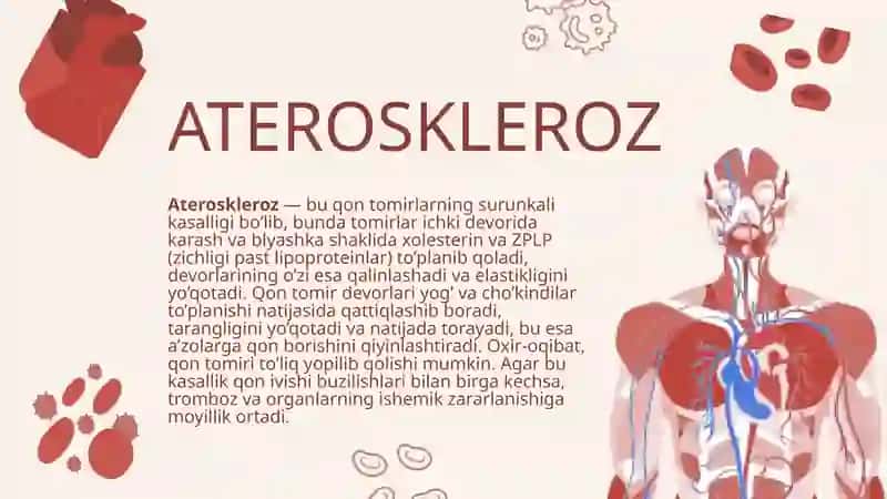 Ateroskleroz 3