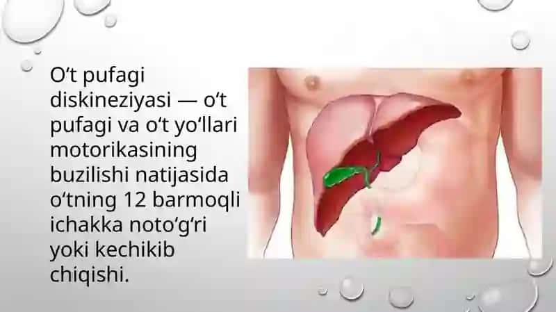 Oʻt pufagi diskineziyasi 3