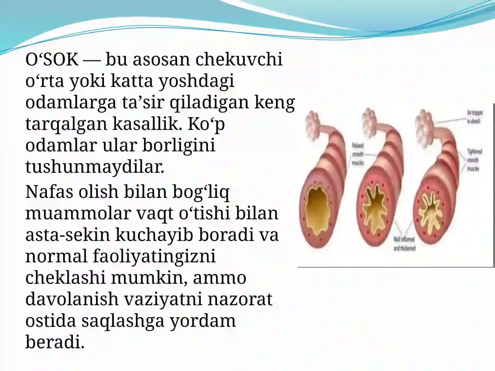 O‘pkaning surunkali obstruktiv kasalligi 3