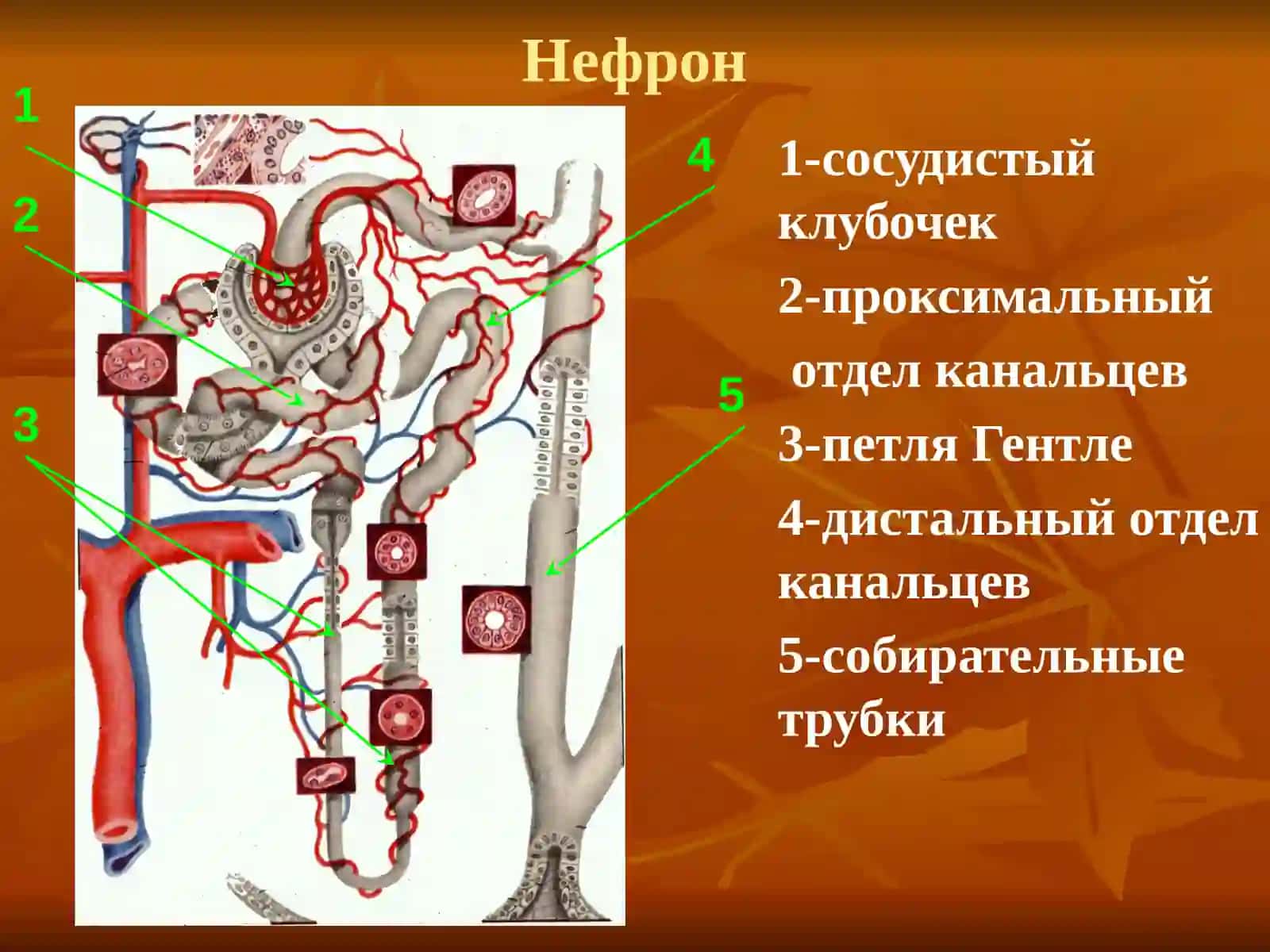 Хронический гломерулонефрит 3