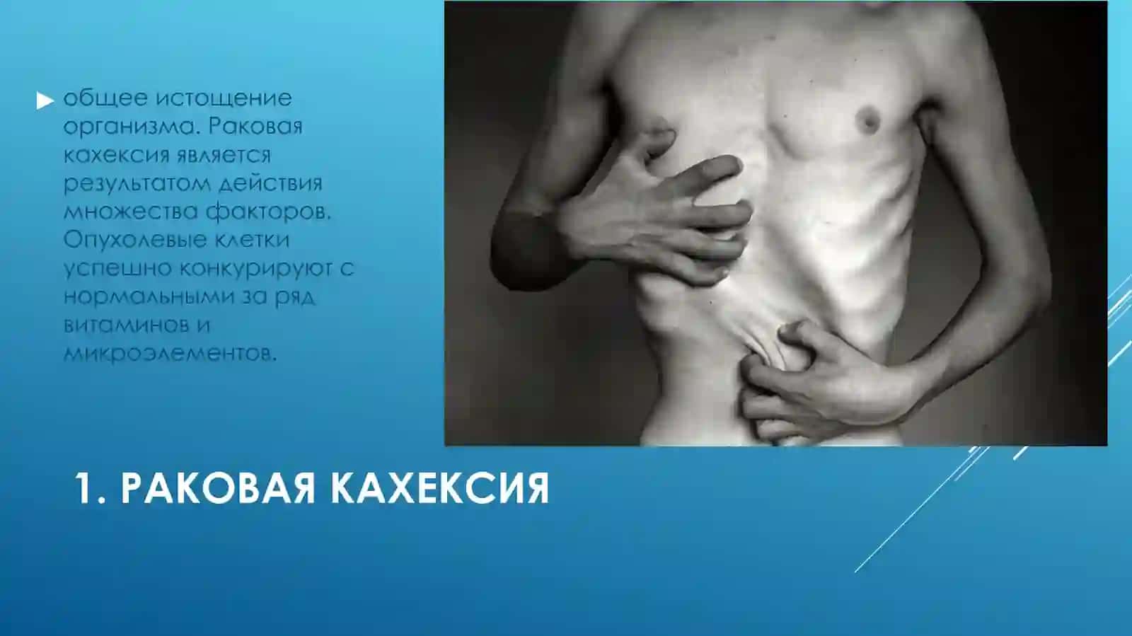 Опухоль 3