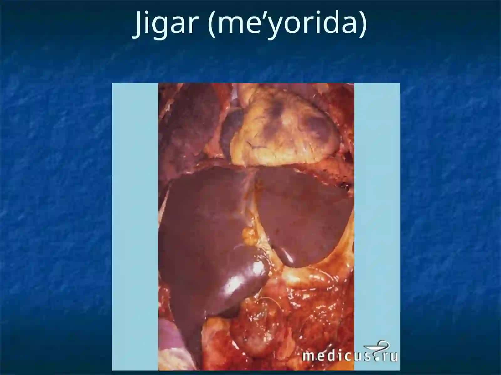 JIGARSIRROZI 3