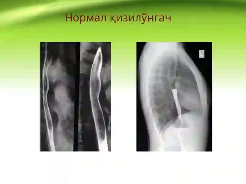 Қизилўнгач 3