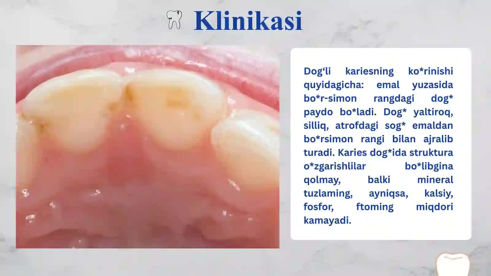 DOG’ BOSQICHIDAGI KARIES 3