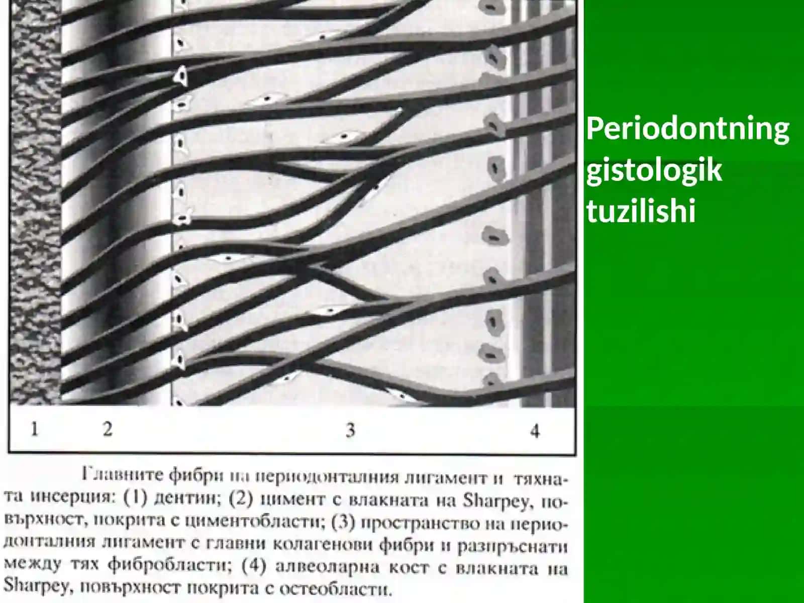 Periodontit 3