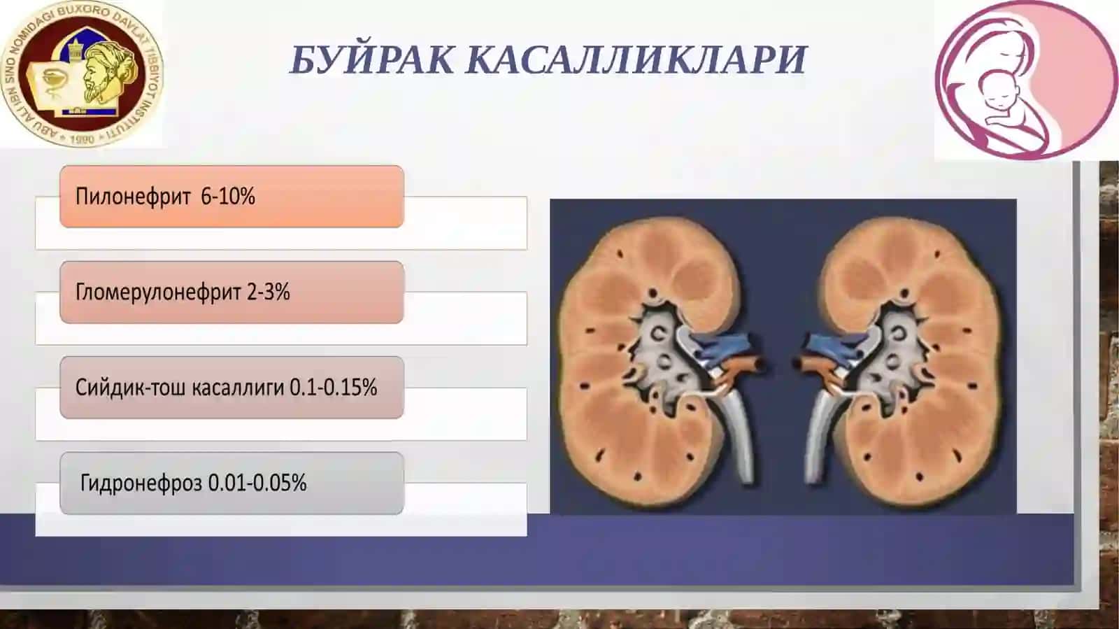 Пиелонефрит 3