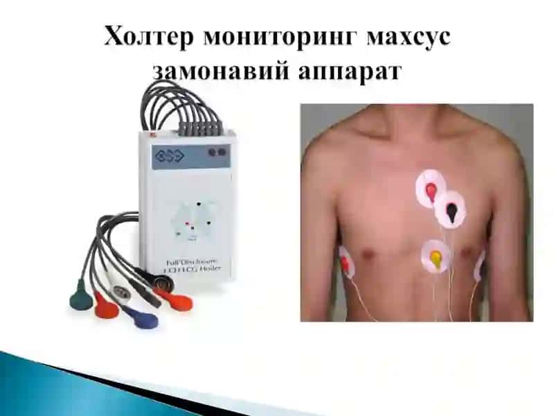 Электрокардиограмма 3