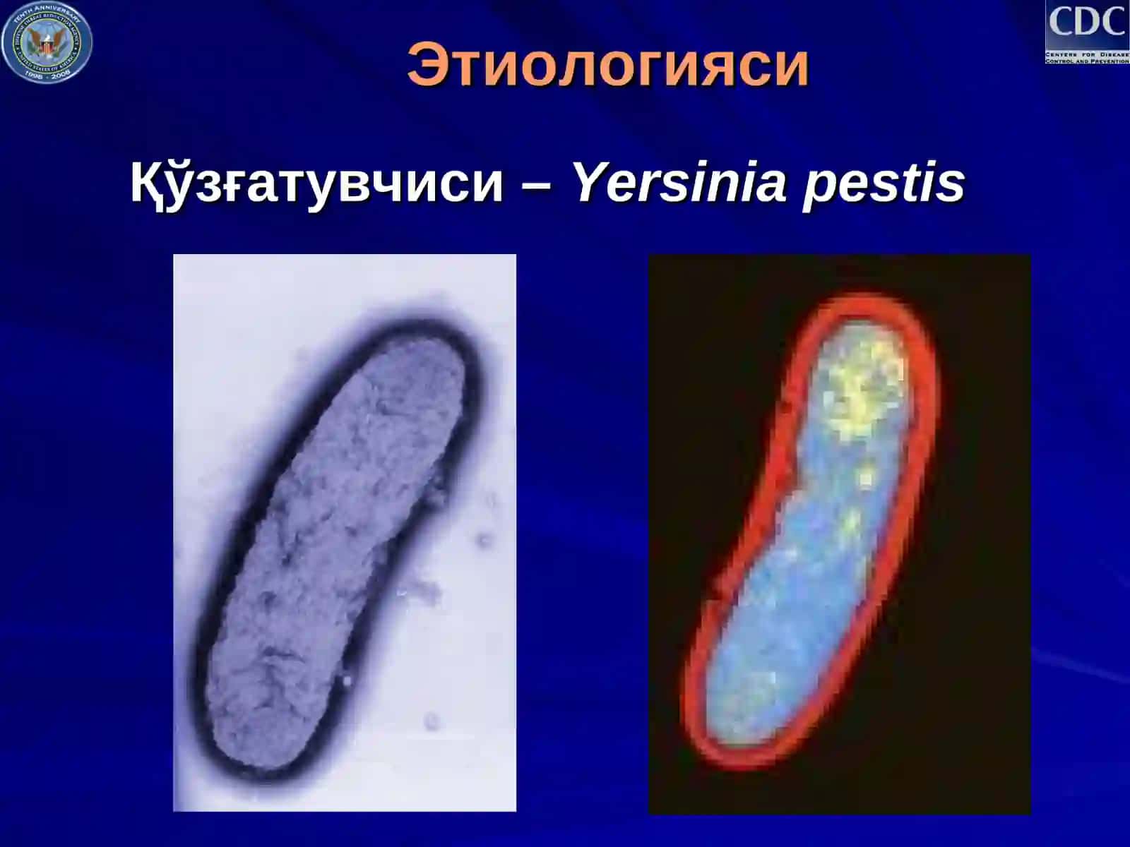 Ўлат(чума) 3