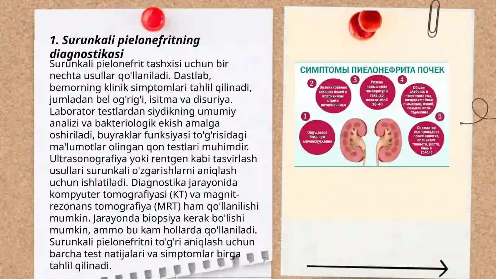 Surunkali pielonefrit 3