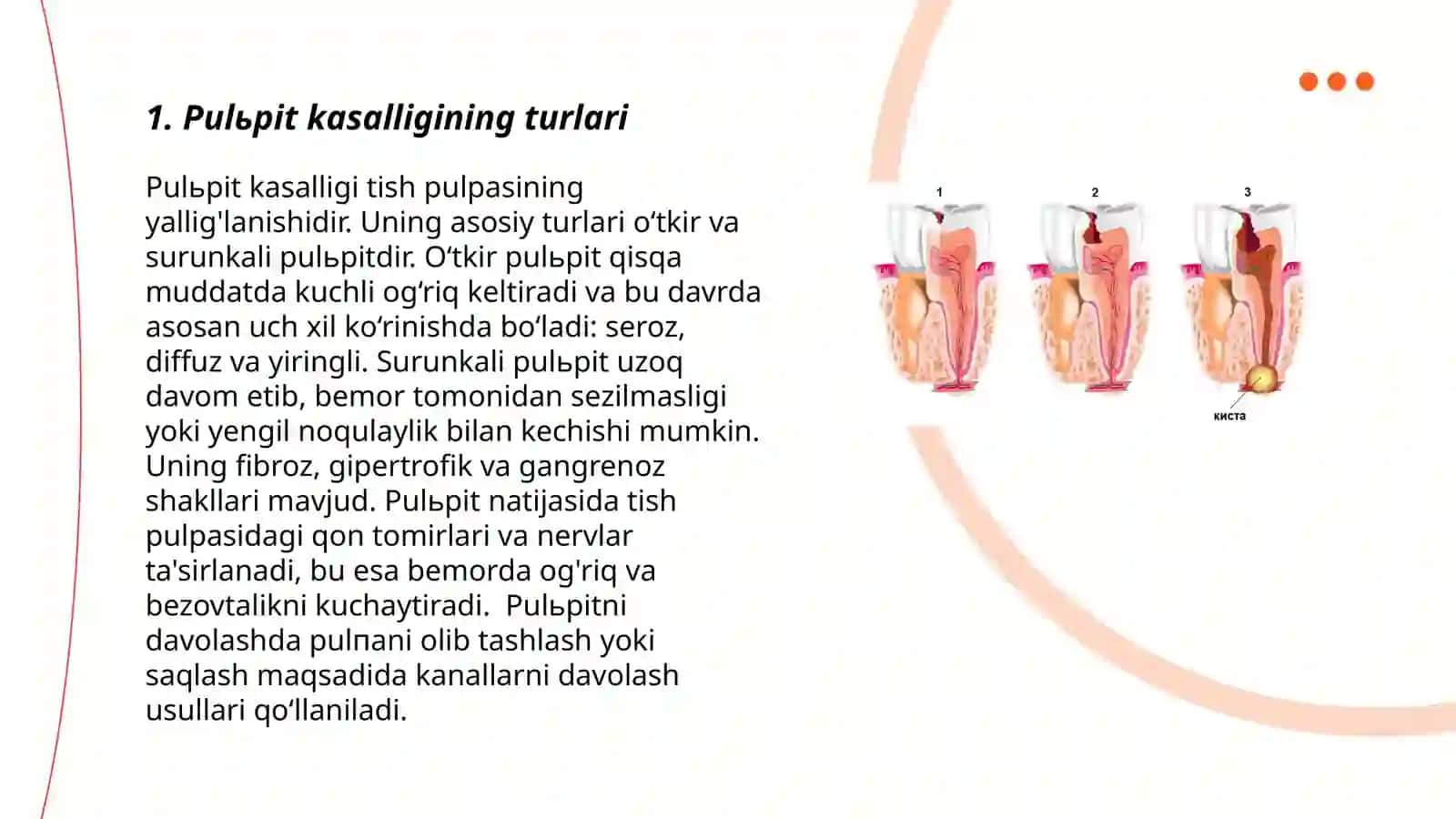 Pulьpit kasalligi 3