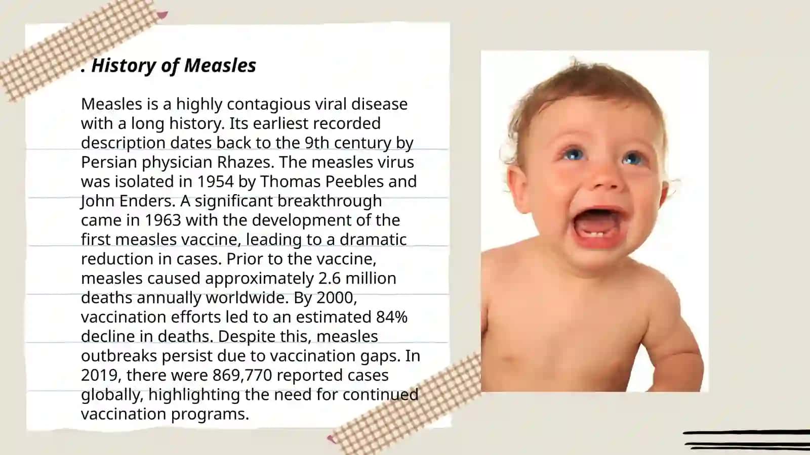 Measles 3