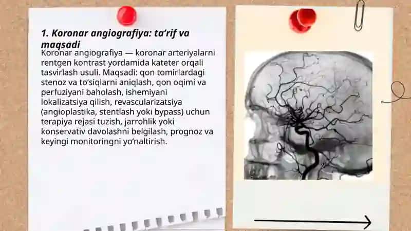 Koronar angiografiya 3