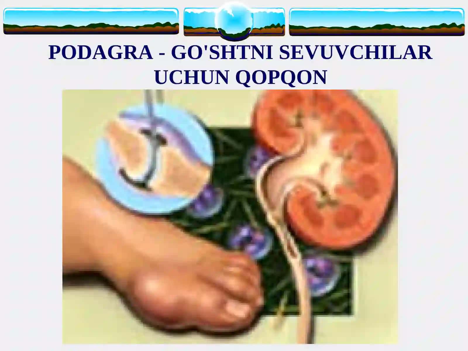 PODAGRA 3