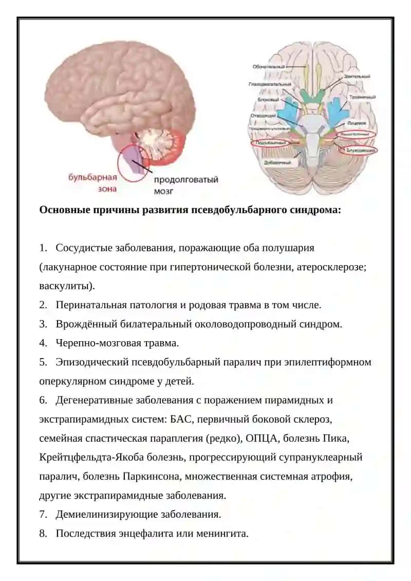 Бульбарный и псевдобульбарный паралич 3
