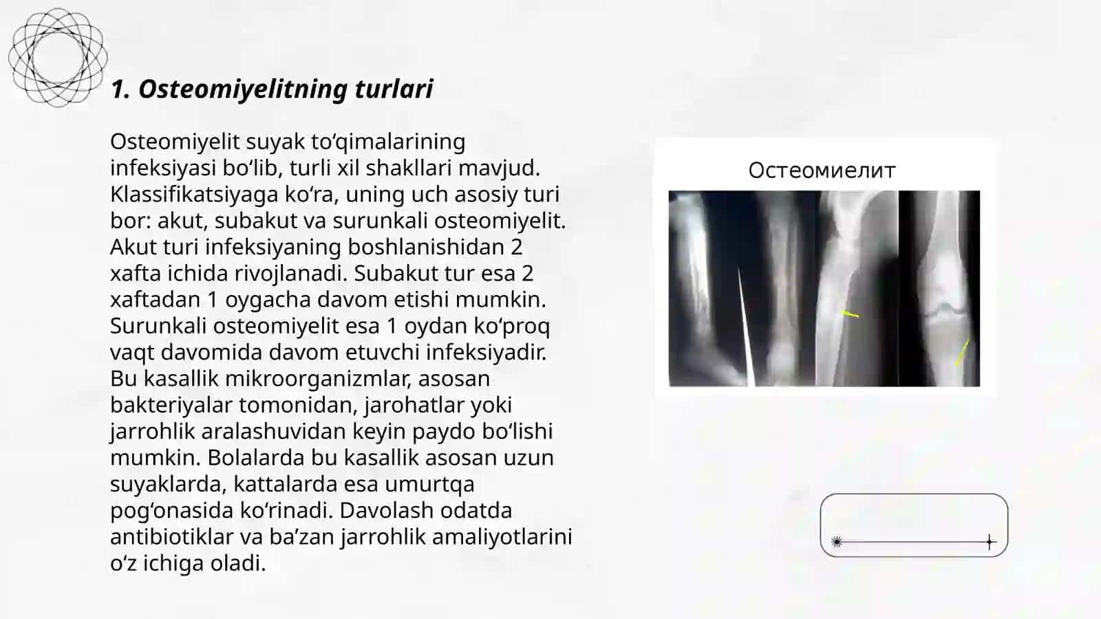 Osteomiyelit 3