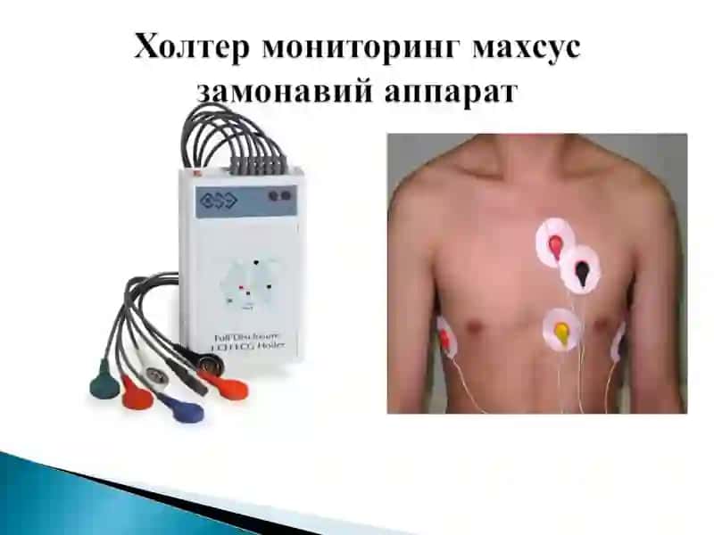 Юрак касалликларини замонавий текшириш усуллари 3