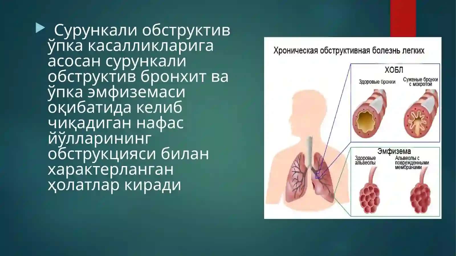 Сурункали обструктив ўпка касалликлари 3