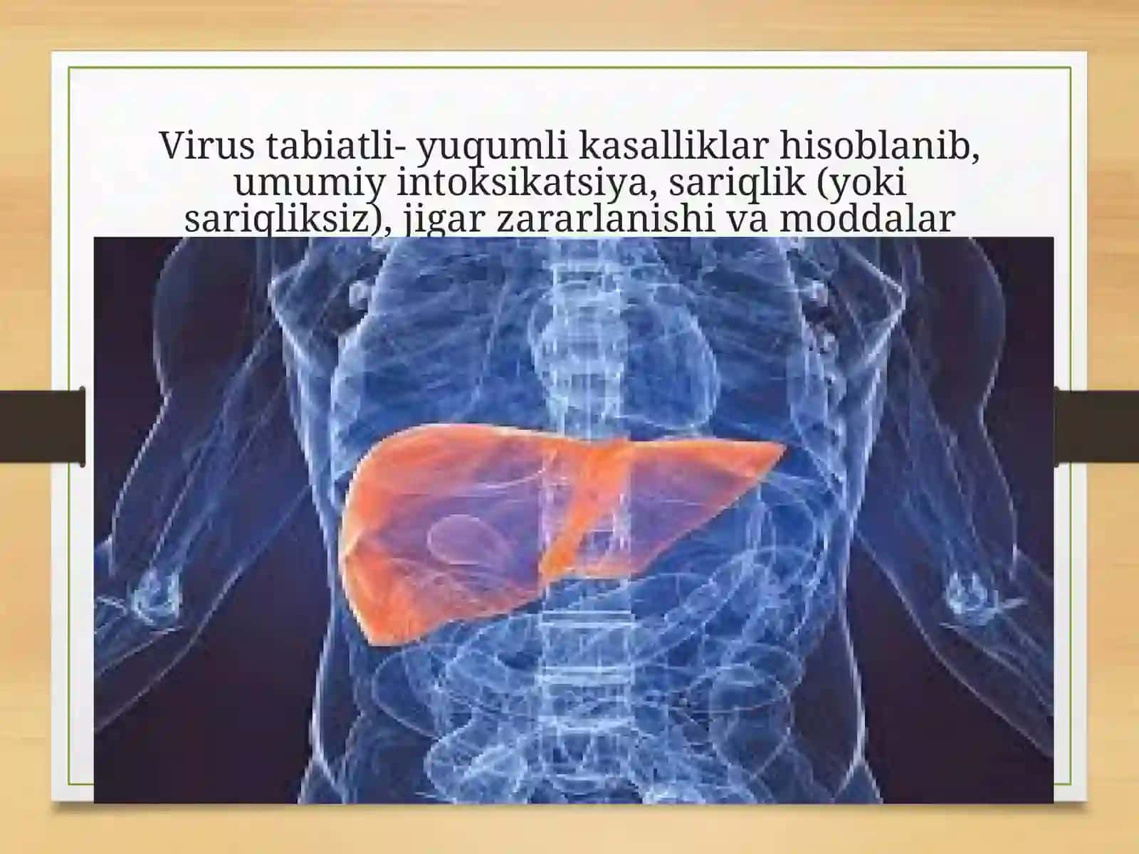 Virusli gepatitlar 3