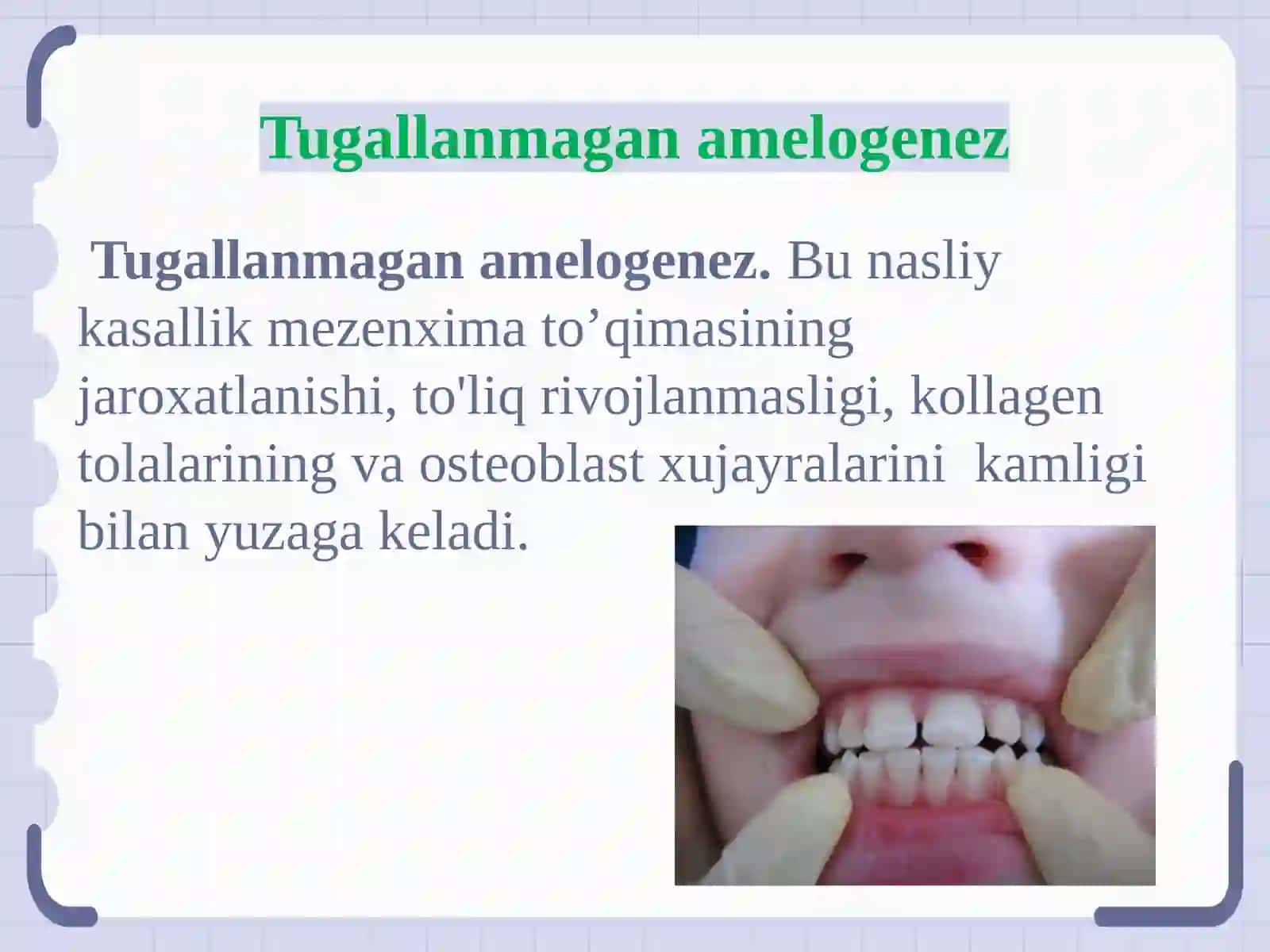 Tugallanmagan amelogenez 3