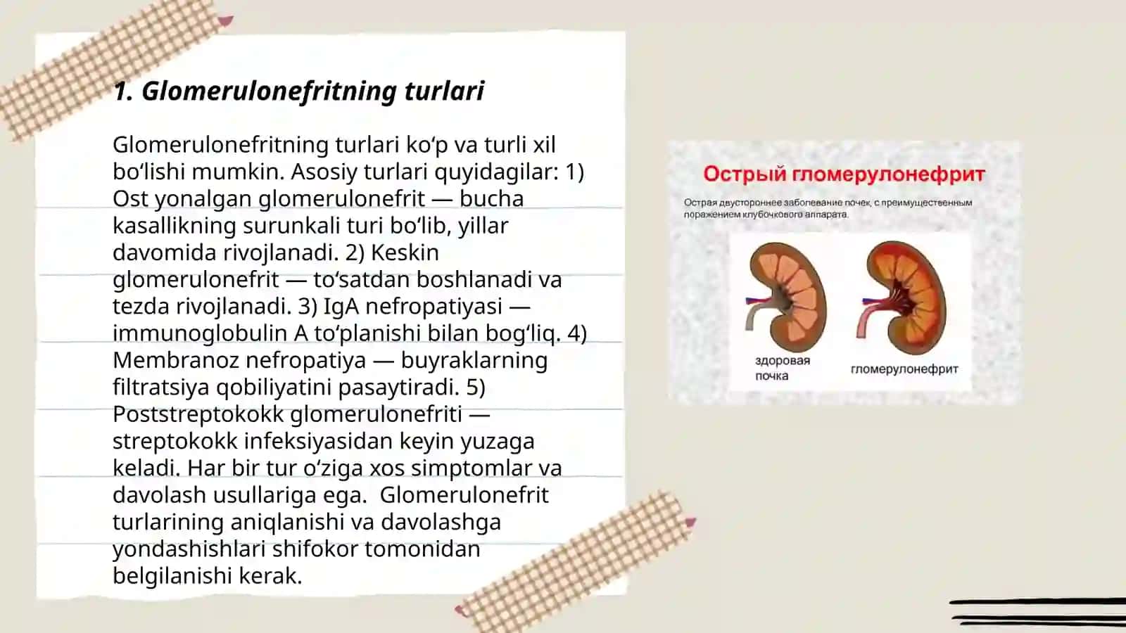 Glomerulonefrit 3