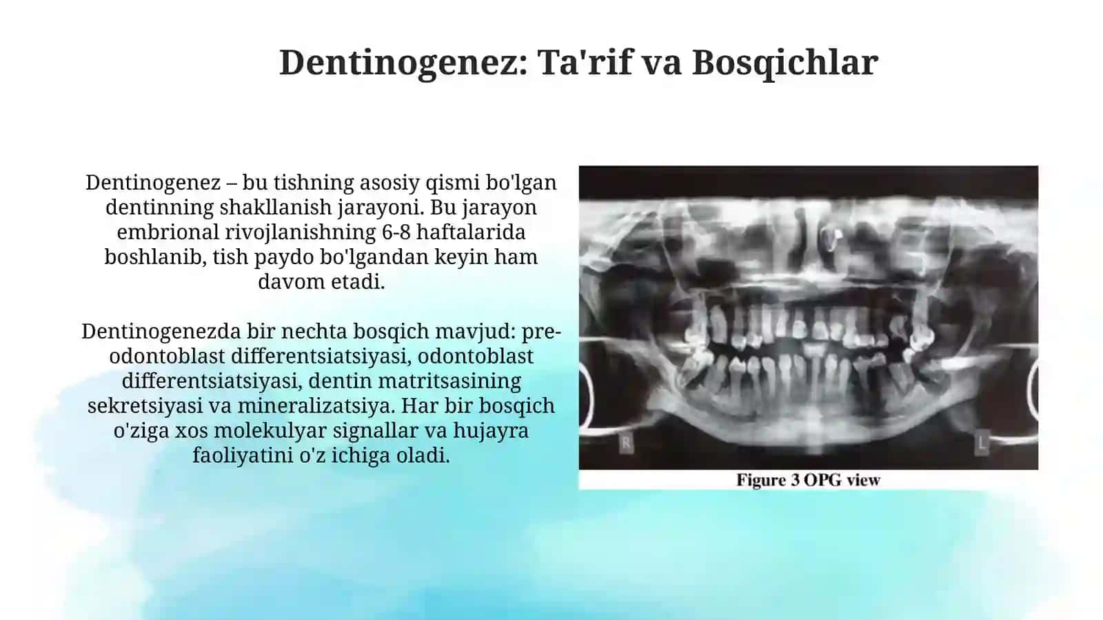 Dentinogenez 3